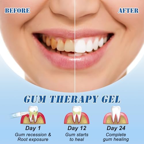 Neslemy™ Gum Shield Therapy Gel, Neslemy Gum Gel, Dentizen Gum Therapy Gel, Teeth Whitening Essence Pen, Gum Instant Treatment Gel, pack of 3